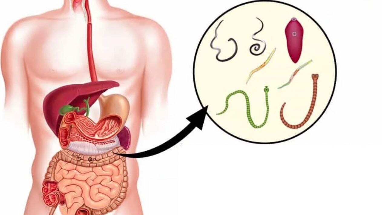 tipos de parásitos en el cuerpo