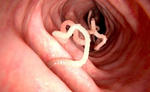 gusanos en el cuerpo humano