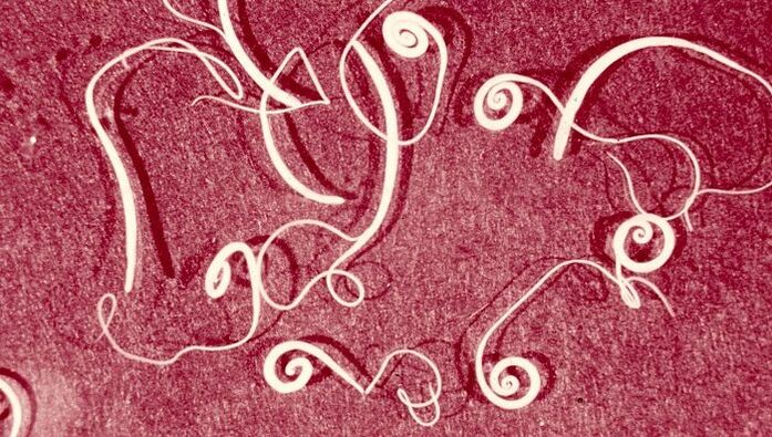 Tricinella
