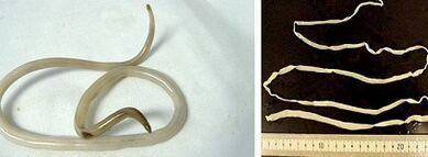 tipos de parásitos en el cuerpo humano