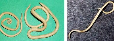 ¿Qué parásitos puede tener una persona